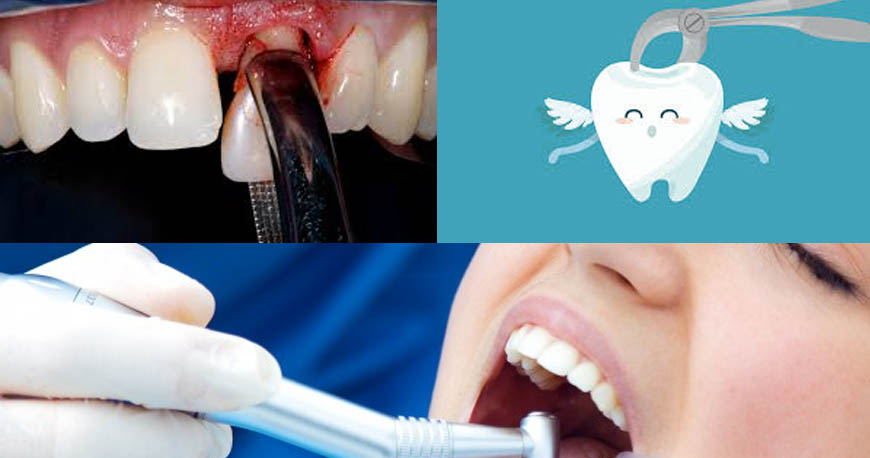 dental treatments in Kuwait